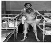 [NSFW] Margit Schwartz, age 31, a survivor of Bergen-Belsen concentration camp, pictured in the hospital soon after liberation. April 1945. [1922 u00d7 2747] from hlbalbums pk bergen